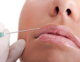 lipofiling visage