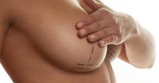 Quand faut-il changer les implants mammaires?